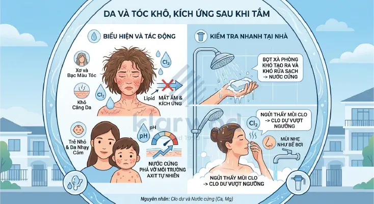 Da khô, tóc xơ và 5 dấu hiệu nước cứng trong nhà cần xử lý ngay