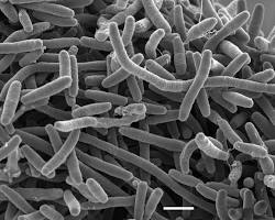 Legionella pneumophila qua kính hiển vi