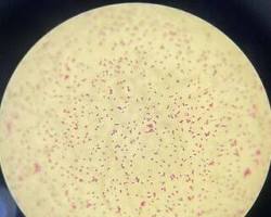 Total Coliform qua kính hiển vi